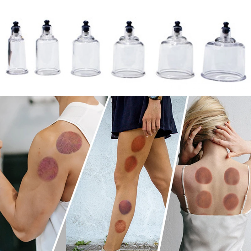 19 Pieces Professional Vacuum Acupuncture Cupping Massager Therapy Cans Vacuum Cupping Care Anti-Cellulite Suction Cups 3