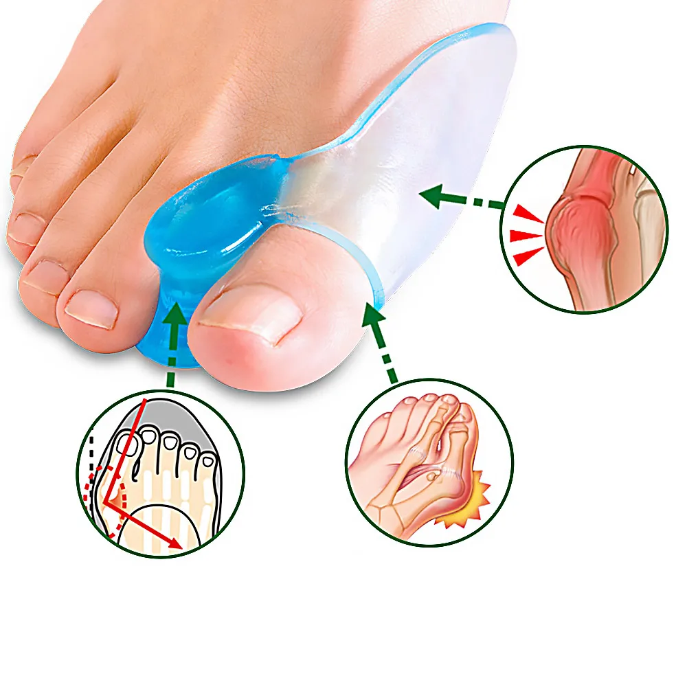Silicone Toe Separator Finger Feet Care Protector Gel Toe Orthopedic Bunion Hallux Valgus Corrector Pedicure Spacer 6