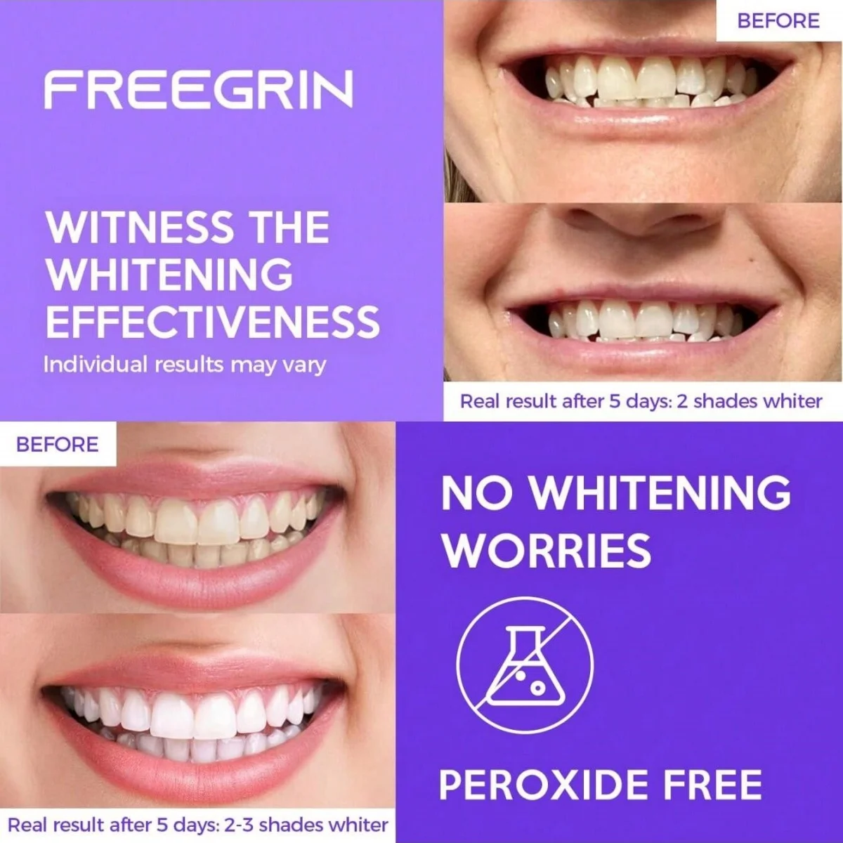 Deluxe Teeth Whitening Strips Kit Image 5
