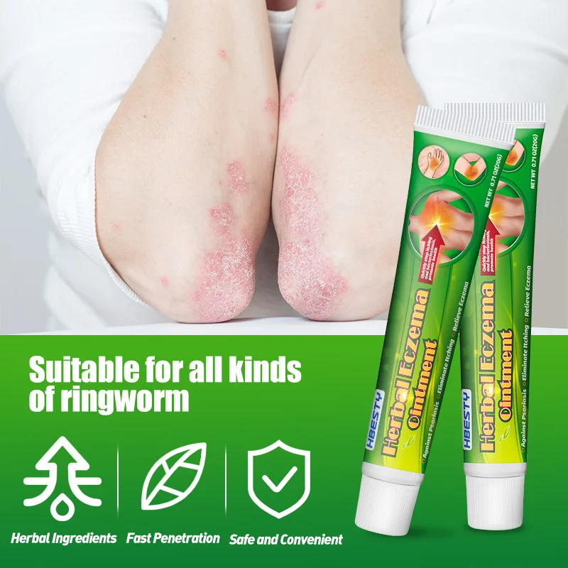 Antiseptic,Health & beauty,Herbal Moss Cleansing Cream for Skin Topical Care Cream Damp Poison Clearing Herbal Itching