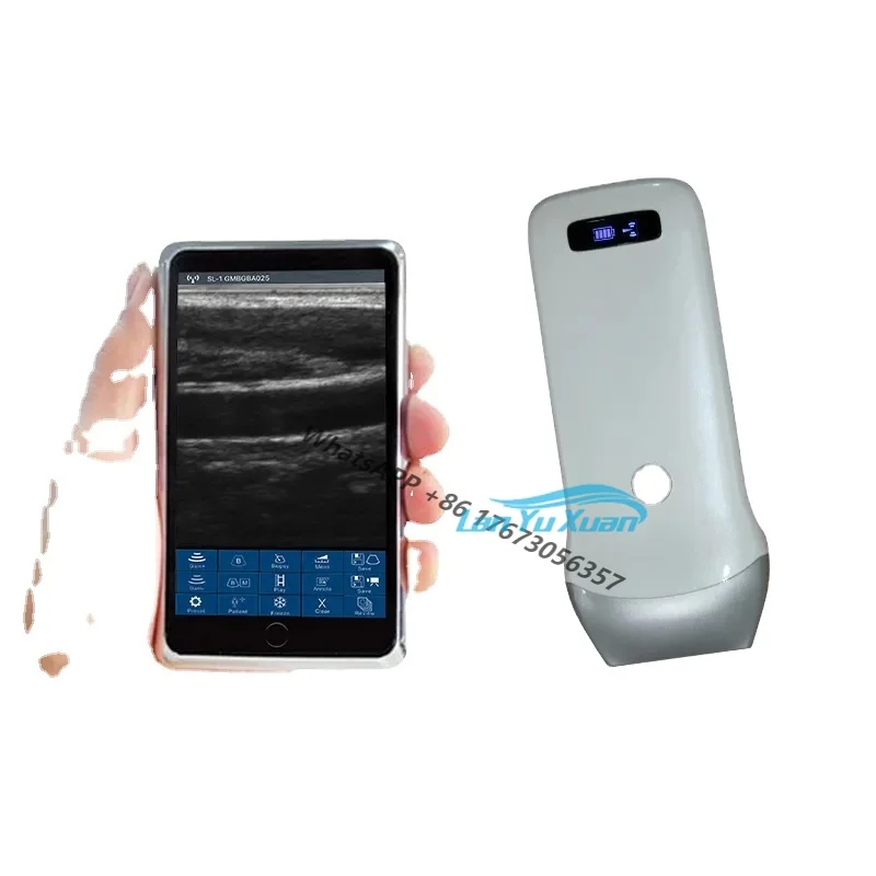 

Handheld Pocket Convex Liner Probe Ultrasound Scanner Machine Doppler