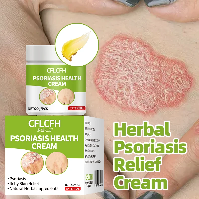 

Psoriasis Treatment Cream Eczema Eczematoid Dermatitis Fungus Antibacterial Anti-itch Health Ointment Skin Care 20g