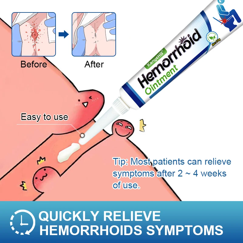 2Pcs Hemorrhoid Ointment Treat Internal And External Hemorrhoid Anal Pain Itch Relief Cream Powerful Hemorrhoids Cream A1274