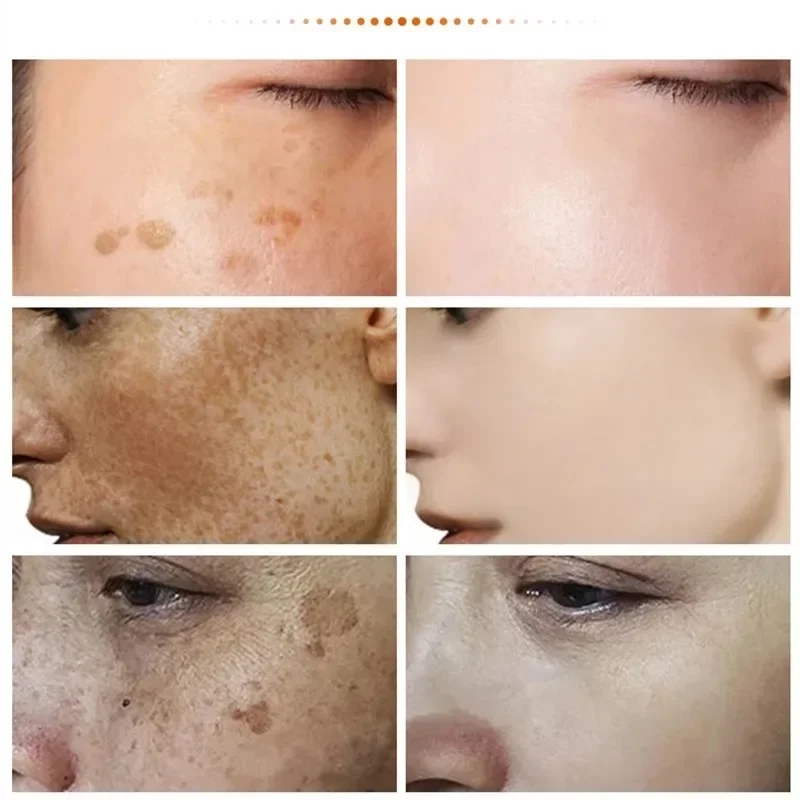 Women\'s Whitening Spot Removing Cream Remove Dark Spots Fade Melanin Brighten Cream Improve Dullness Whitening Lotion Face Care