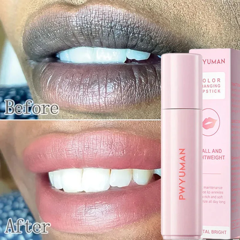 Lips Pink Cream Fresh Bleaching Treatment Remove Dark Smoke Lips Lip Balm Whitening Moisturizing Serum Dilute Melanin Lip Care lips pink fresh lightening bleaching cream treatment remove dark smoke lips lip balm whitening moisturizer nourishing serum