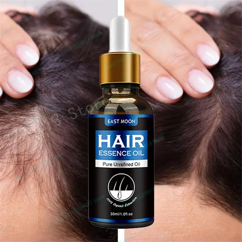 

Biotin Fast Oil Hair care Regrowth Serum Hair Thinning Treatment Liquid Anti-Hair Loss For Women Amp Men hair products