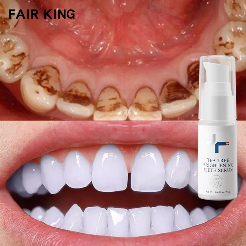 

Whitening Teeth Essence Powder Oral Hygiene Cleaning Serum Removes Plaque Stains Tooth Bleaching Dental Tool Toothpaste Tea Tree