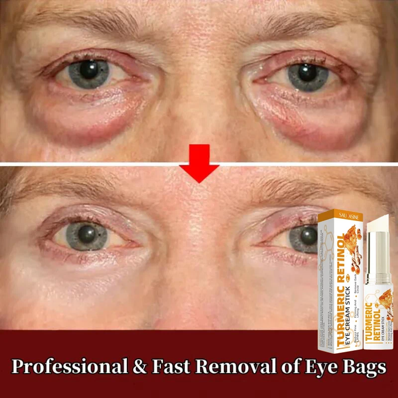 

Anti-Wrinkle Eye Cream Retinol Eyestick Remove Eye Bags Dark Circles Lifting Firming Fade Fine Lines Anti-Puffiness Eye Care