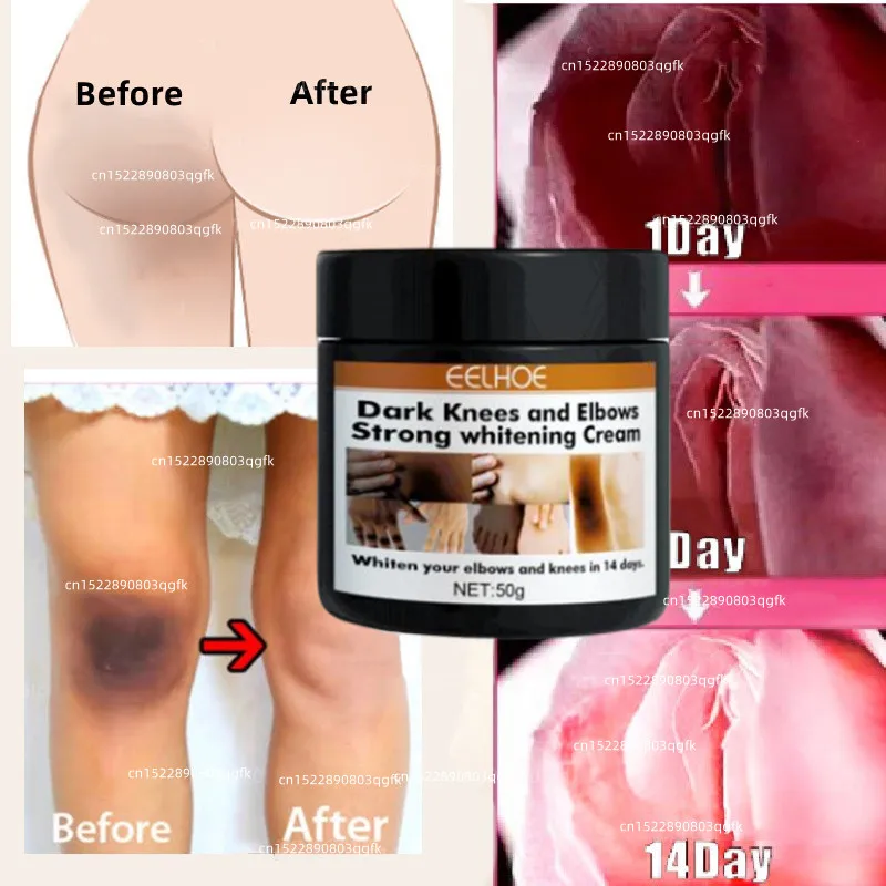 Body Whitening Cream Private Parts Underarm Bleaching Serum Whiten Butt Knee Brighten Inner Thigh Intimate Dark Remove Melanin