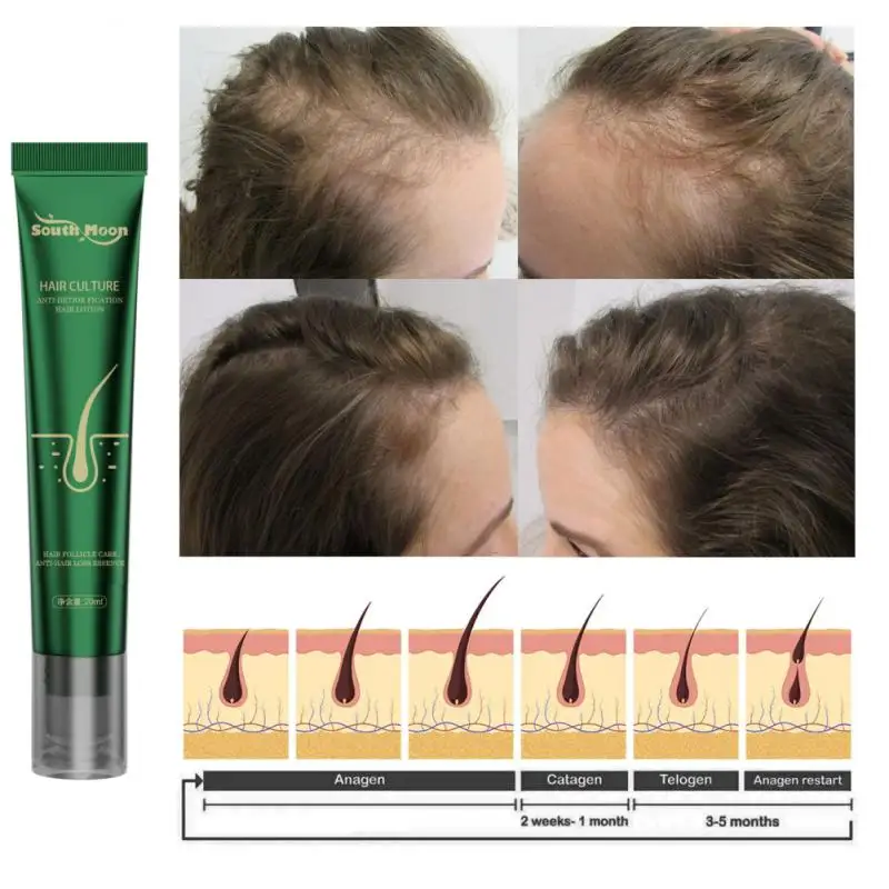 Biotin Fast Hair Growth Oil Hair Regrowth Serum Thinning Growth Liquid Anti-Hair Loss For Women and Men