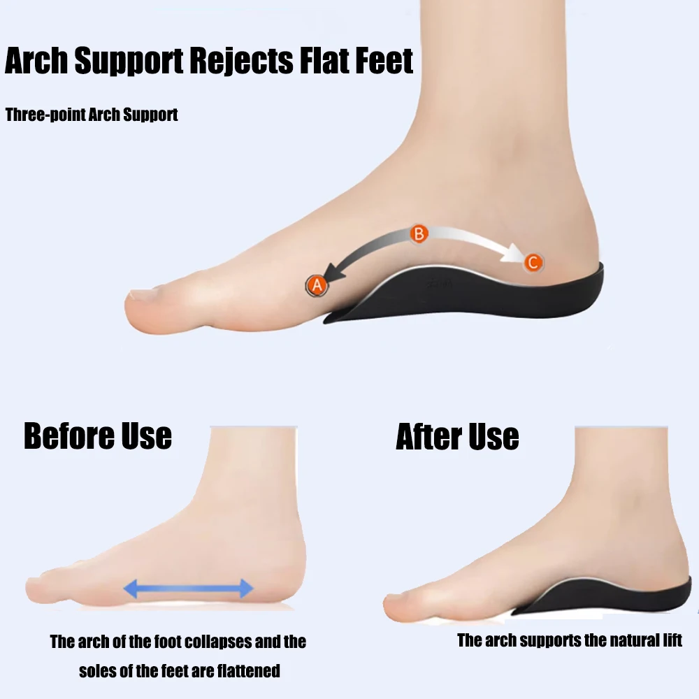 Orthopedic Insoles for Shoes Women Men Flat Feet X/O Legs