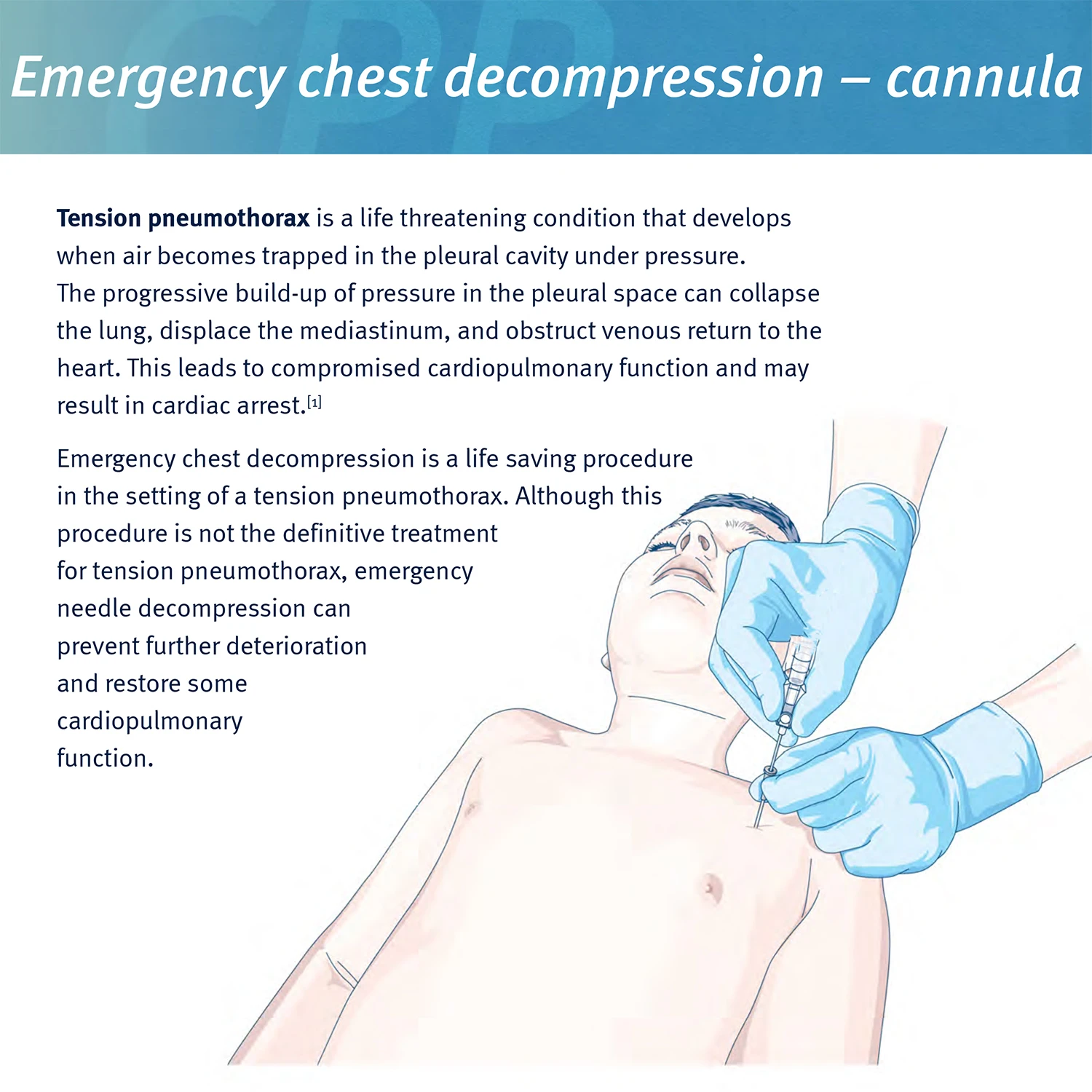 Pneumothorax Needle Trauma Medical Ifak Kit - Image 5