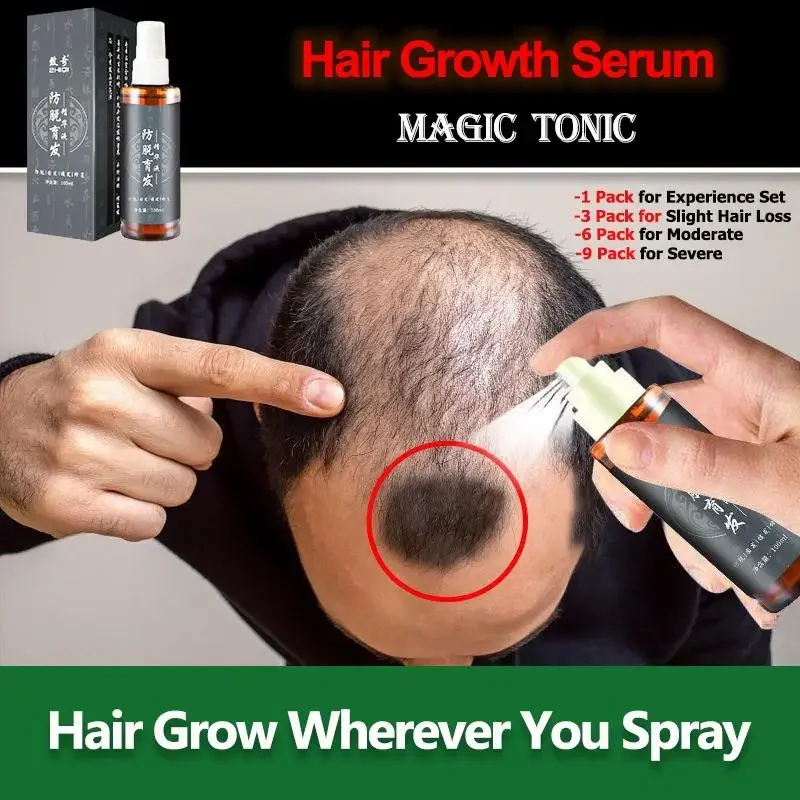 Ginger Hair Growth Spray Anti Hair Loss Essential Oil Products Treatment Hair Thinning Frizzy Fast Growth Serum Men Women Care
