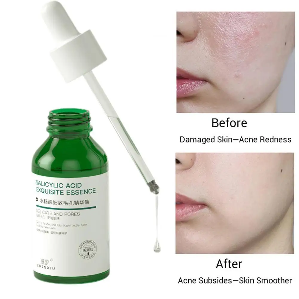 

Pore Shrinking Serum Repairs Large Pores Salicylic Acid Face Essence Anti-wrinkle Facial Serum Oil Control Whitening Skin Care