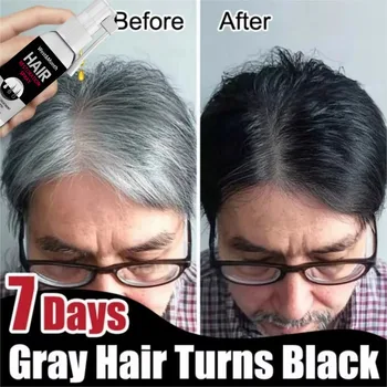 Siero Trattamento Capelli Grigi e Bianchi: Copre i Capelli Bianchi con un Colore Nero Naturale, Spray Riparatore Anti-Caduta, Ripristina la Salute dei Capelli