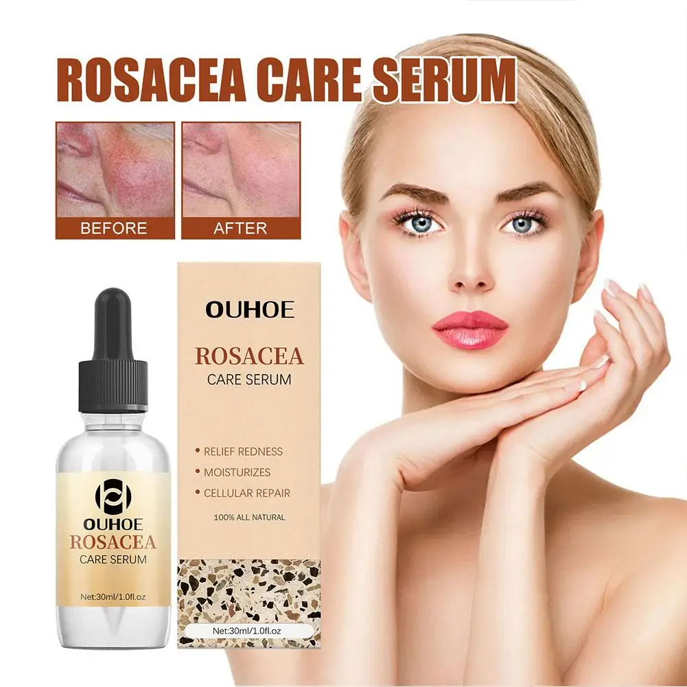 Rosacea Cure Serum Instant Repair Facial Red Blood Rosacea Redness Care Serum Moisturize Improve Skin Face Sooth Itching O1C4