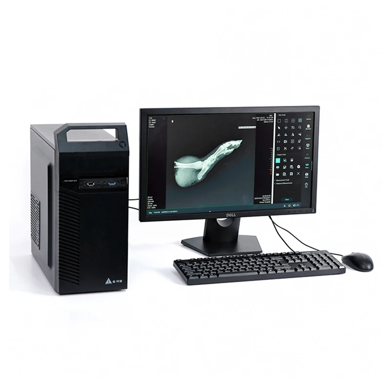 Рисунок 3 - Портативная рентгенографическая система