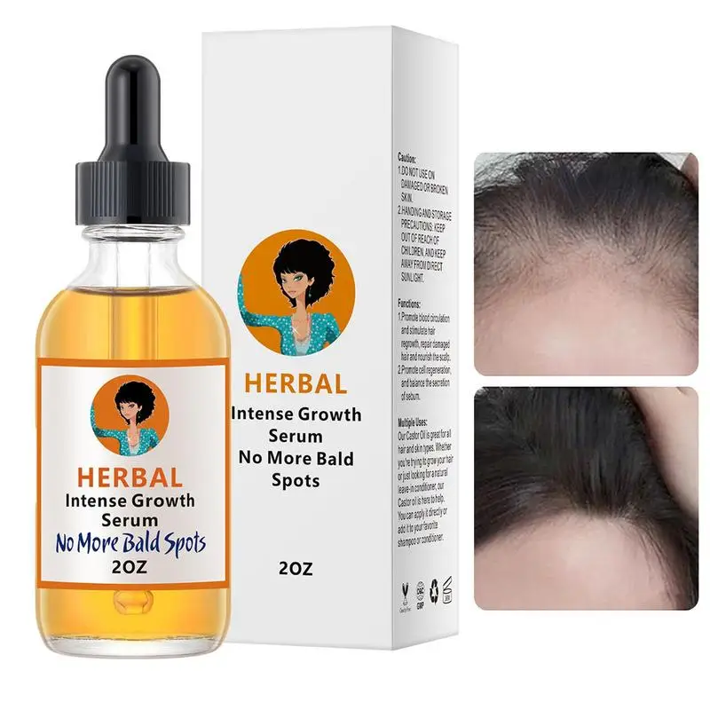 Herbal Intense Hair Growth Serum Products Anti-Hair Loss Fast Grow Repairs Follicles Thinning Treatments Hair Scalp Care