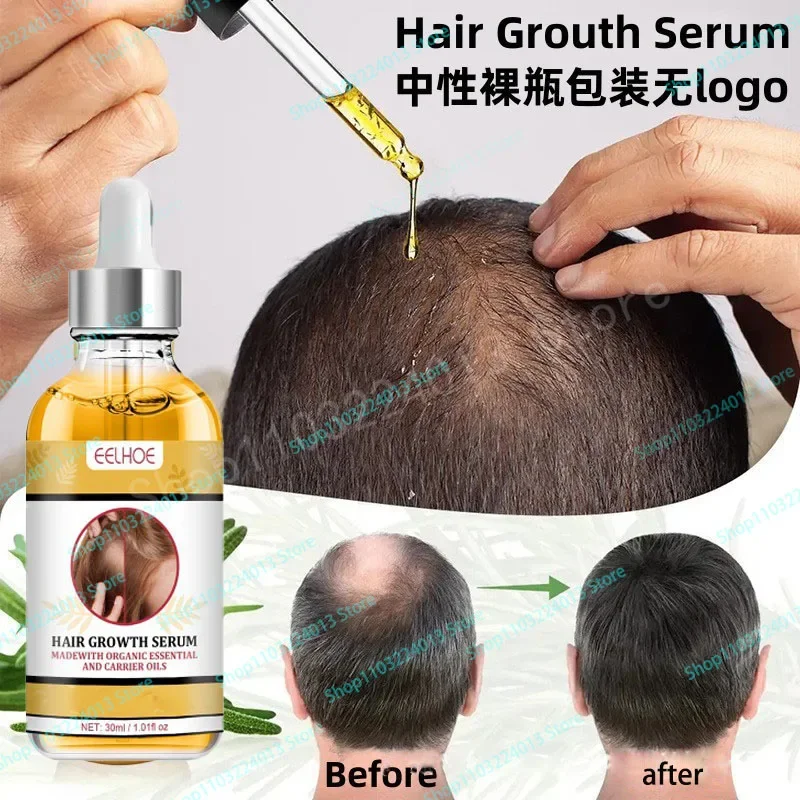 

Hair growth oil Serum products anti Effective Baldness