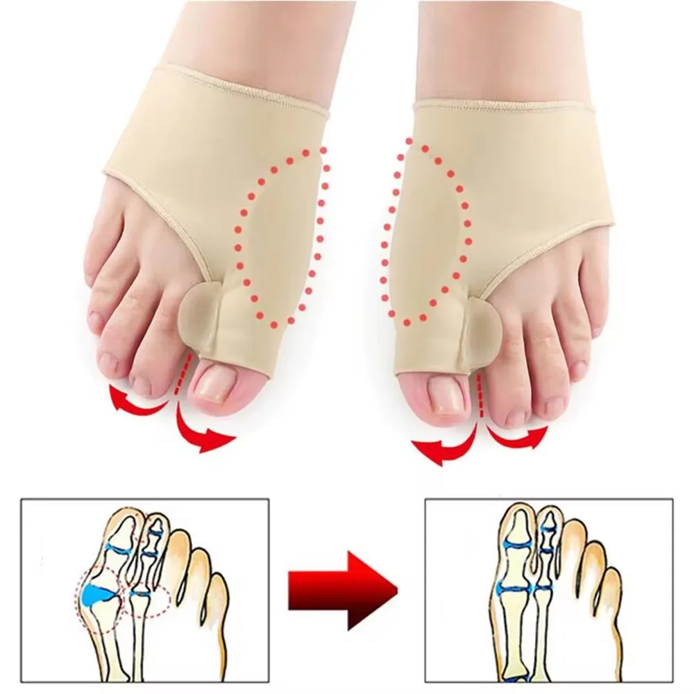 Toe Separator Hallux Valgus Bunion Corrector Hammer Toe Straightener Foot Pain Relief 1Pair