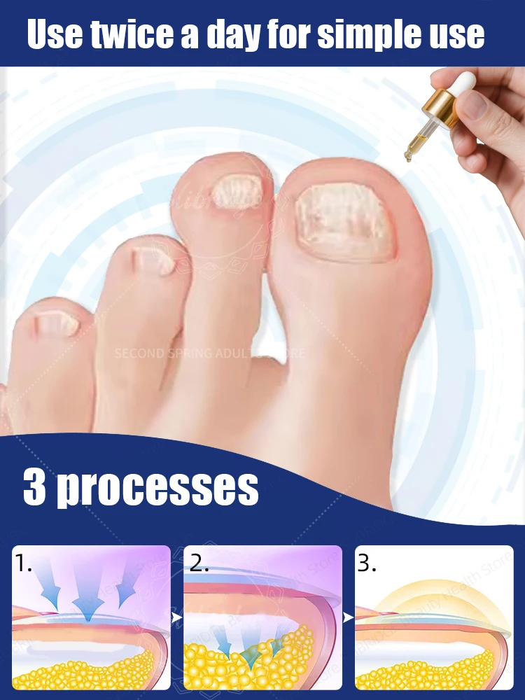 2025 Toenail Fungus Patch Waterproof Nail Repair Patches Ingrown Correction Sticker Discolored Damaged Foot Care Tool
