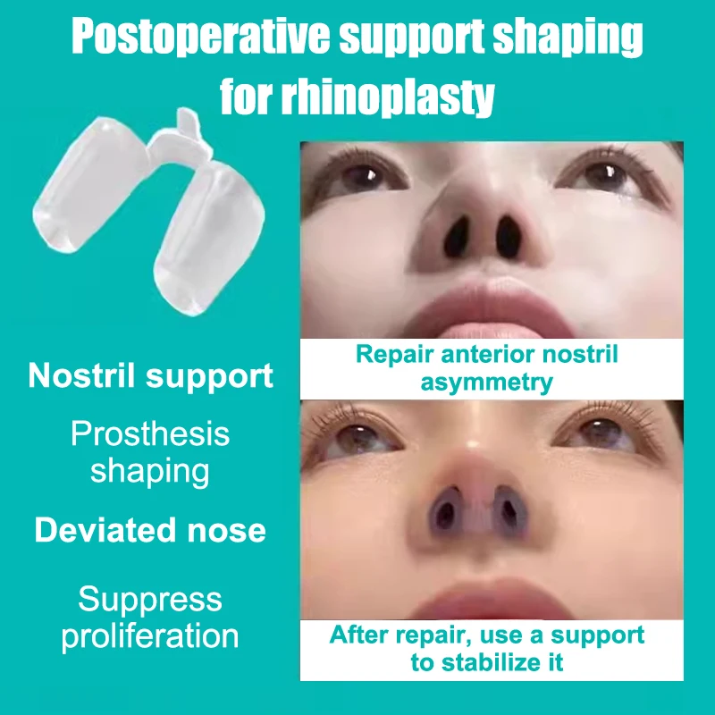 Pooperační rhinoplasty nosní dírka podpora silikon tvarování křivý nos korekce fixator silica gel nos klip