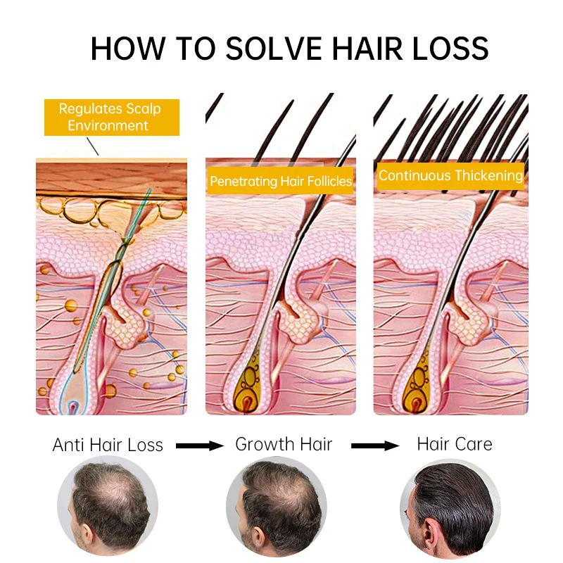 PURC Fast Hair Growth Anti Hair Loss Oil 1ef722433d607dd9d2b8b7: Asia