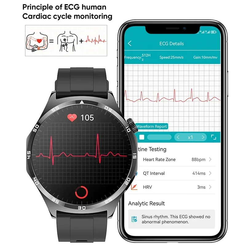  Ʈ ġ ǰ ECG + PPG  ü   ð, Ʈ HD AMOLED ȭ,  ȭ Ʈġ 2024
