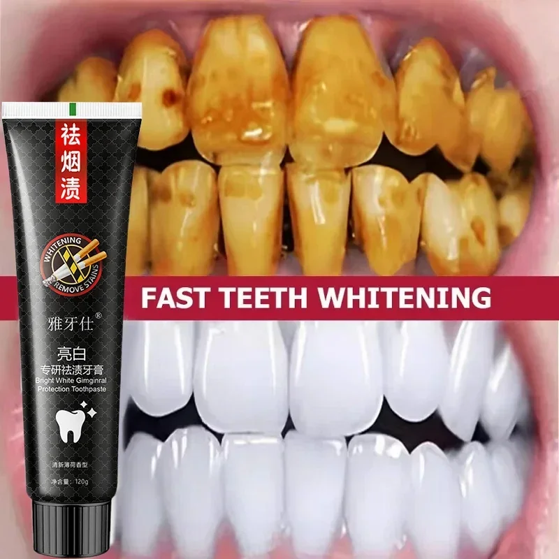 Fast Remove Smoke Stains Toothpaste Remove Plaque Stains Oral Hygiene Cleaning Fresh Breath Teeth Whiten Tools Oral Health Care teeth whitening essence teeth whitening product