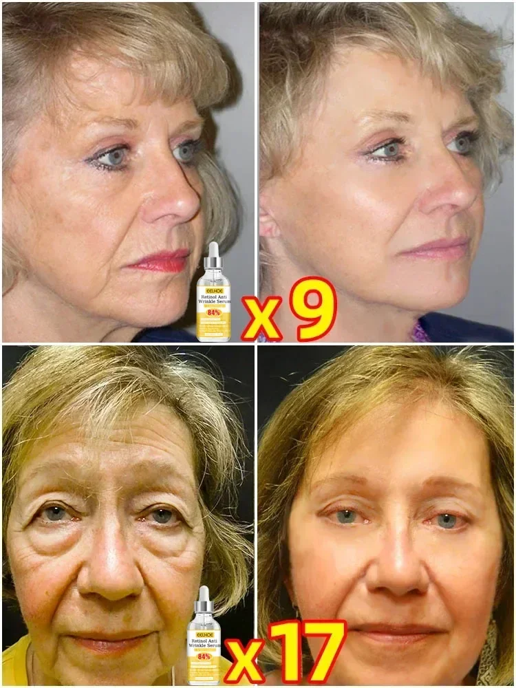 Facial care maintenance health protection nourishment quick problem solving