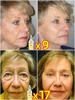 Facial care maintenance health protection nourishment quick problem solving 5