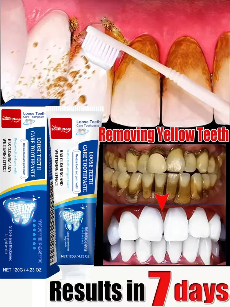 Teeth Whitening Toothpaste Dental Calculus Remover Plaque Stains Cleaning Oral Hygiene Prevent Periodontitis Dental Tools Care