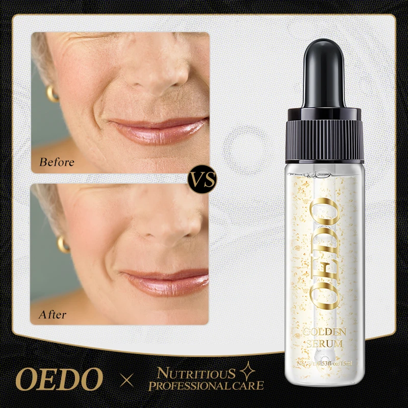 OEDO Gold Serum Anti-Aging Fade Fine Lines Deeply Nourishing Moisturizing hydrating Improve skin tone Facial Treatment Essence 4