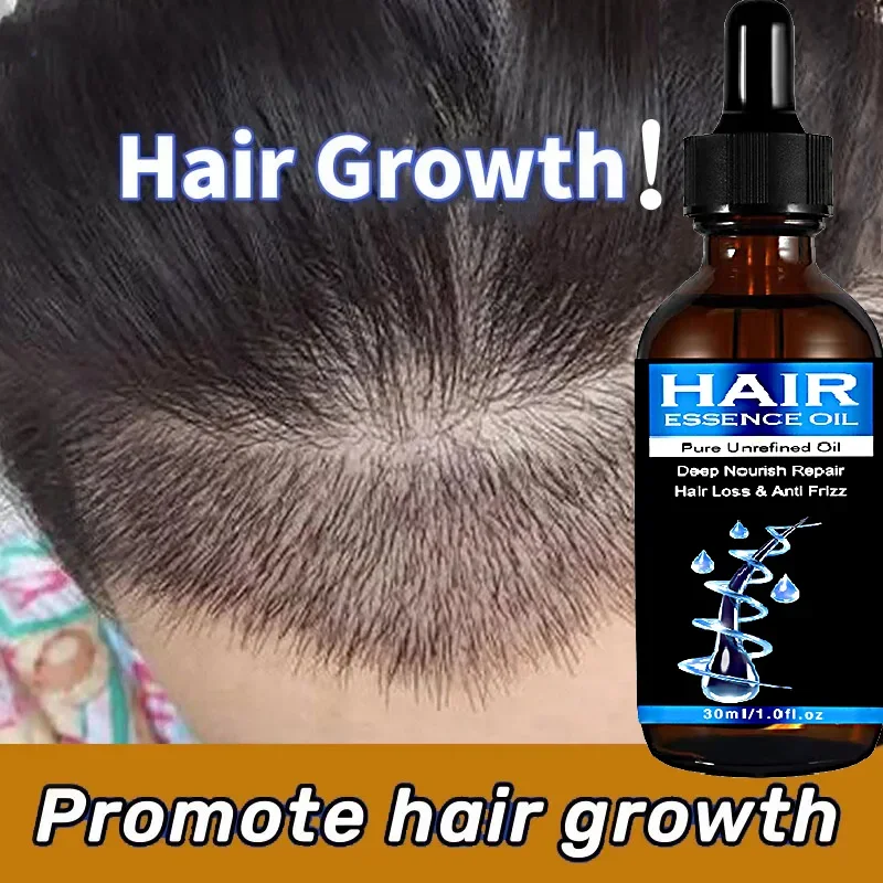 Hair Spray Man Women 30ml Repair Damage Restore Oil Scalp Repair Serum Spray Thicken Hair Health Care hair care products