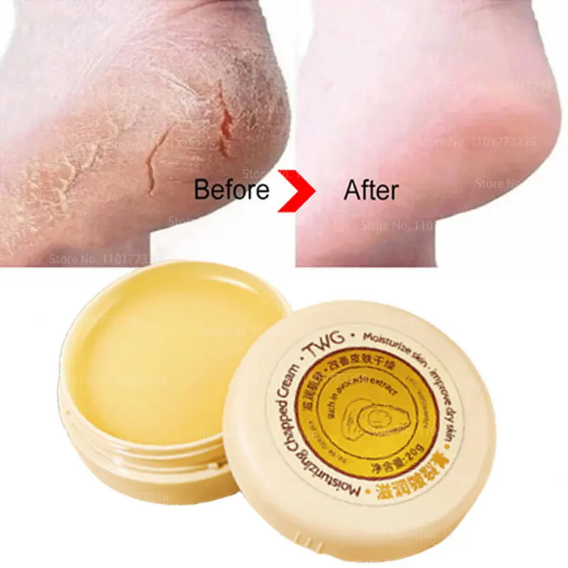 AntiDrying Crack Foot Cream Heel Body Hand Cracked Repair Cream Removal Dead Skin Whitening