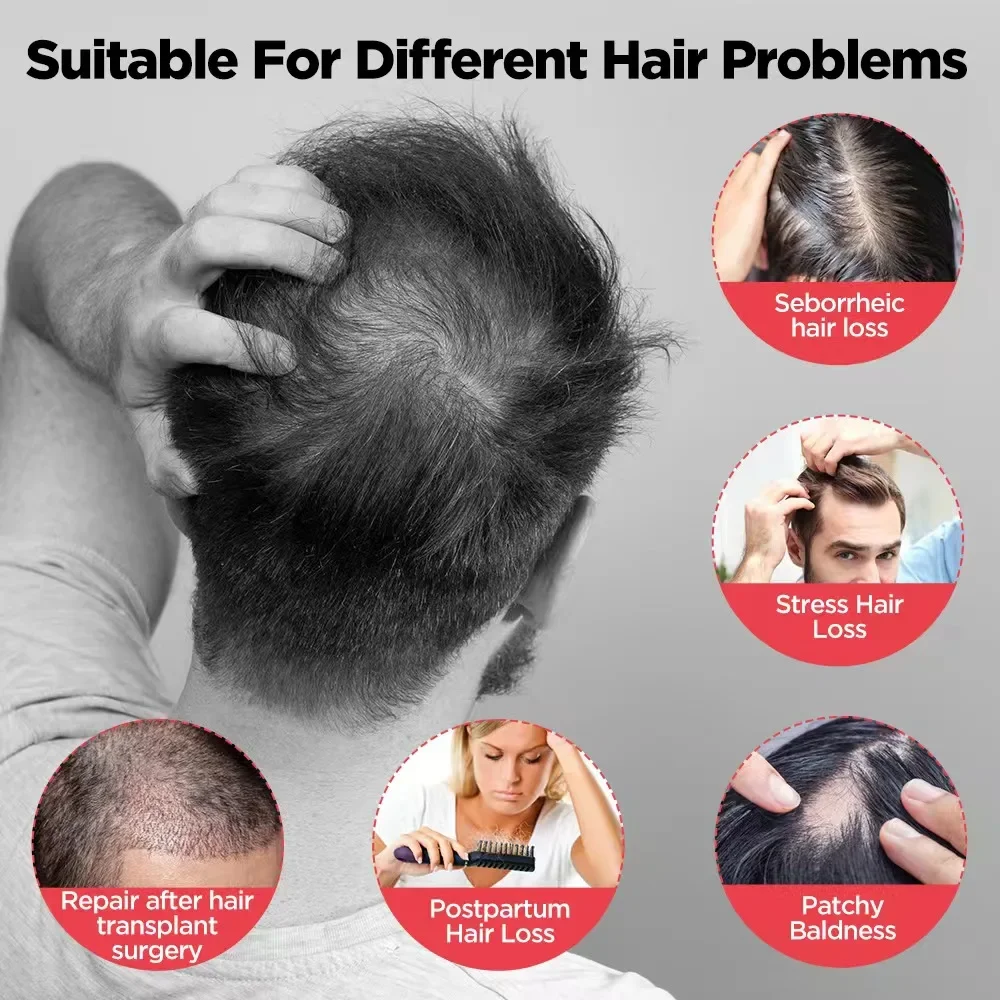 مصباح LED أحمر لعلاج تساقط ونمو الشعر