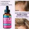 Rapid hair growth essential oil nourishes hair root scalp care repairs hair damage anti-hair loss hair care essence