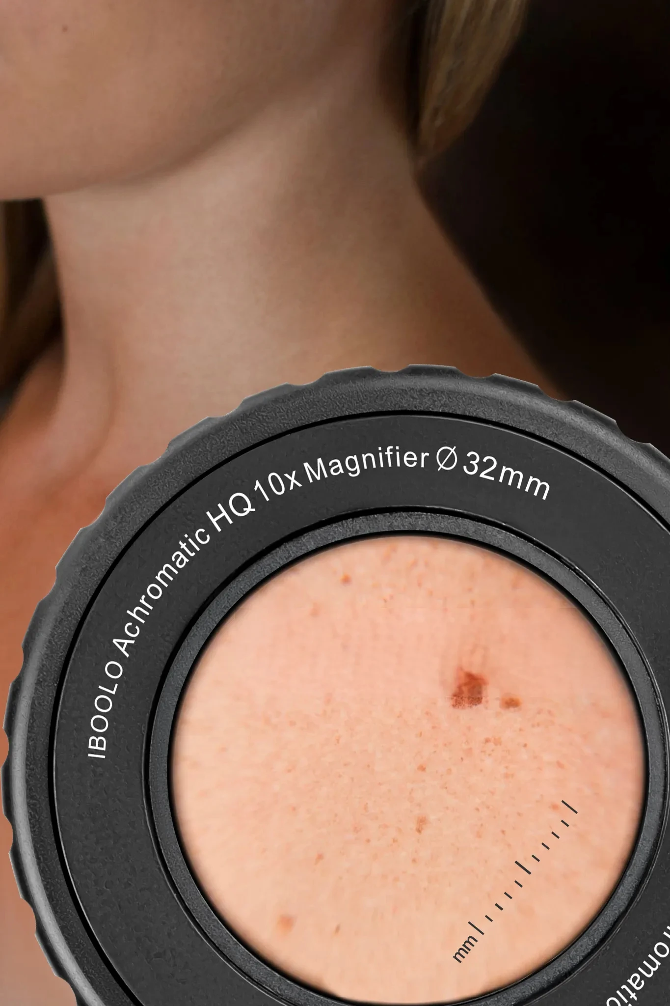 カラーアトラスdermoscopy Dermatoscopy: Pattern analysis of pigmented and non