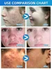 Salicylic Acid  Solution Essence Shrink pores and Acne Spot Removing Shrink Pores Oil-Control Brighten Face Skin Makeup 4