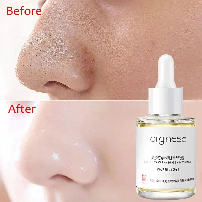 

Lactobionic Acid Pore Shrink Face Serum Hyaluronic Acid Moisturizing Nourish Smooth Pores Repair Essence Firm Korean Cosmetics