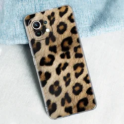 Trendy Leopard Print Phone Case - Sexy and Stylish Cover for Poco X7 Pro (A1)