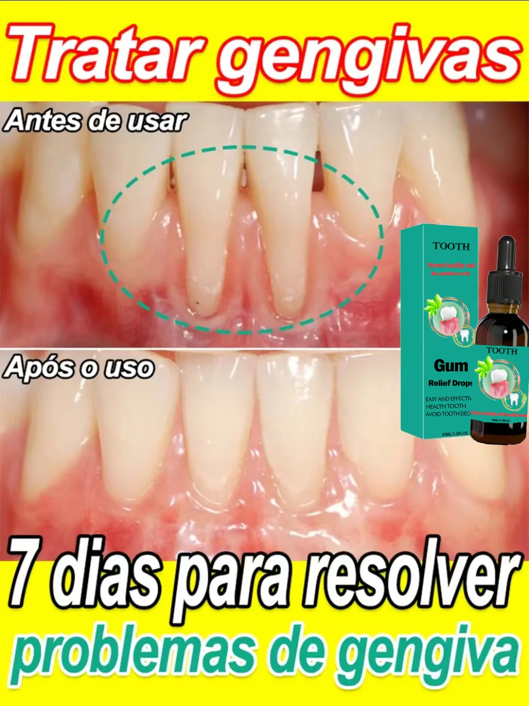 Repair Damaged Gum Problems Relieve Pain Strengthen Restore Dirty Gum Problems