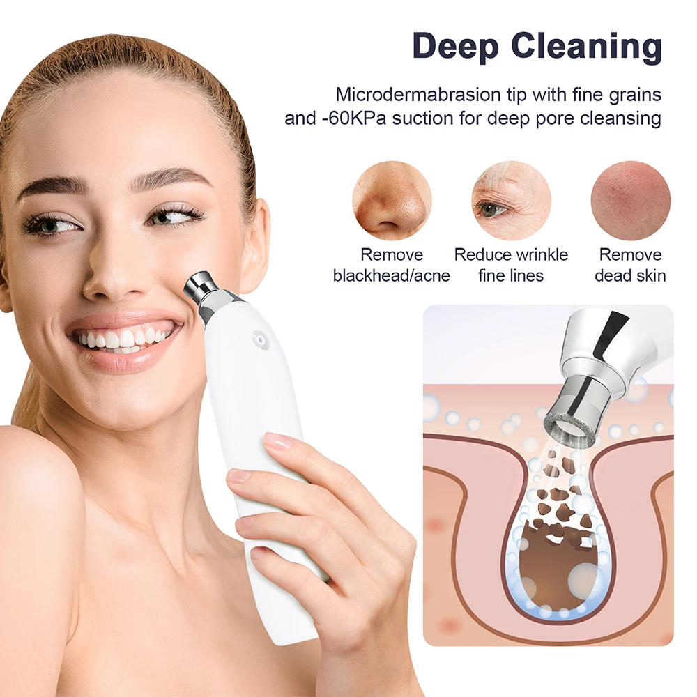Diamond Microdermabrasion Machine 60KPa Suction Power Blackhead Removal Professional Facial Deep Cleasing Device Home Use