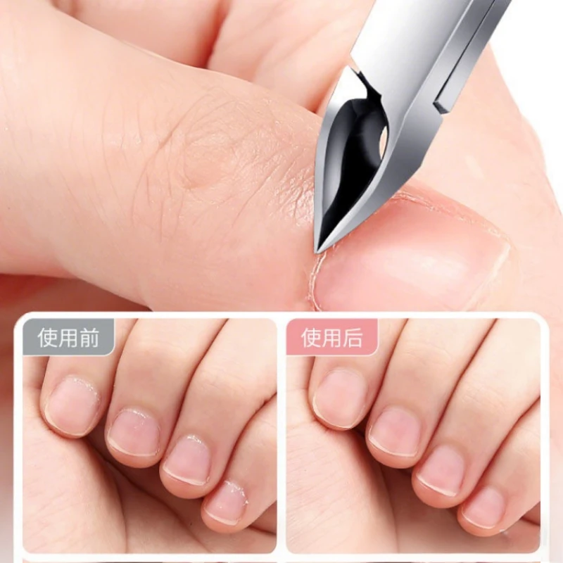 1-4Pcs Toenail Ingrown Nail Art Cuticle Nipper Clipper Edge Cutter Manicure Scissor Plier Tool Pedicure Dead Skin Remover