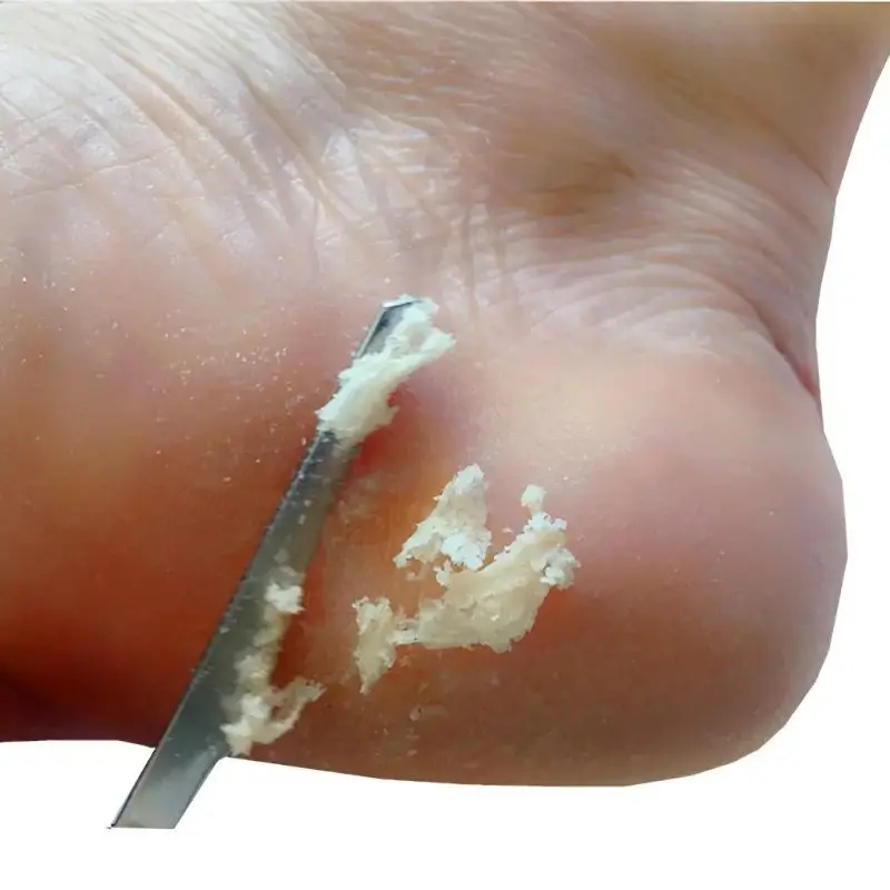 Stainless Steel Foot Knife Dead Skin Remover Toe Nail Shaver Callus Rasp for Pedicure Foot Care Shops