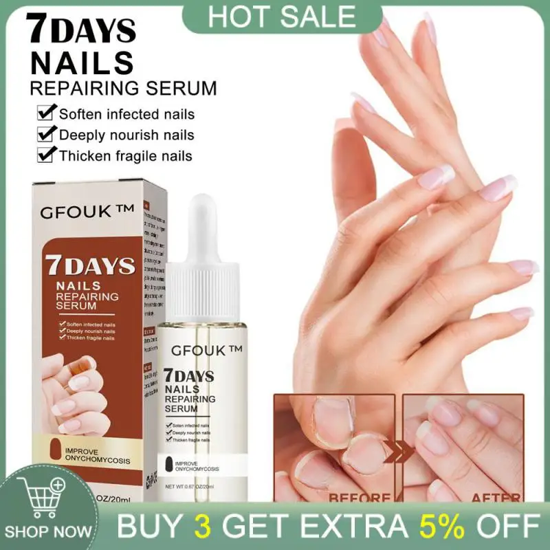 

Nail Repair Easy To Carry Repair Skin Care Onychomycosis Restores Kill Fungi Nursing Liquid Gentle Easy To Use 20ml