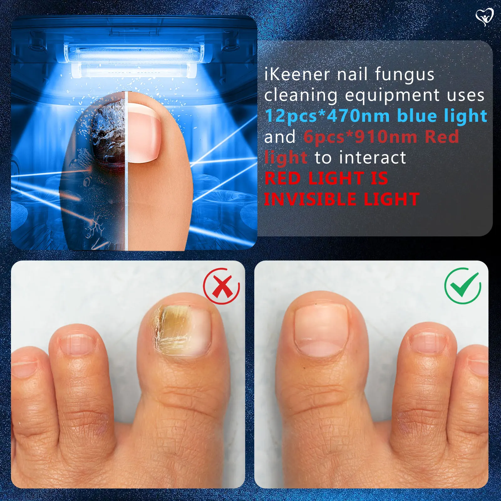 Nail Fungus Remover Personal Health Care 905nm470nm 7Minutes Painless Laser for Multiple Toenail Nail Fungus&Ingrown toenail equipment