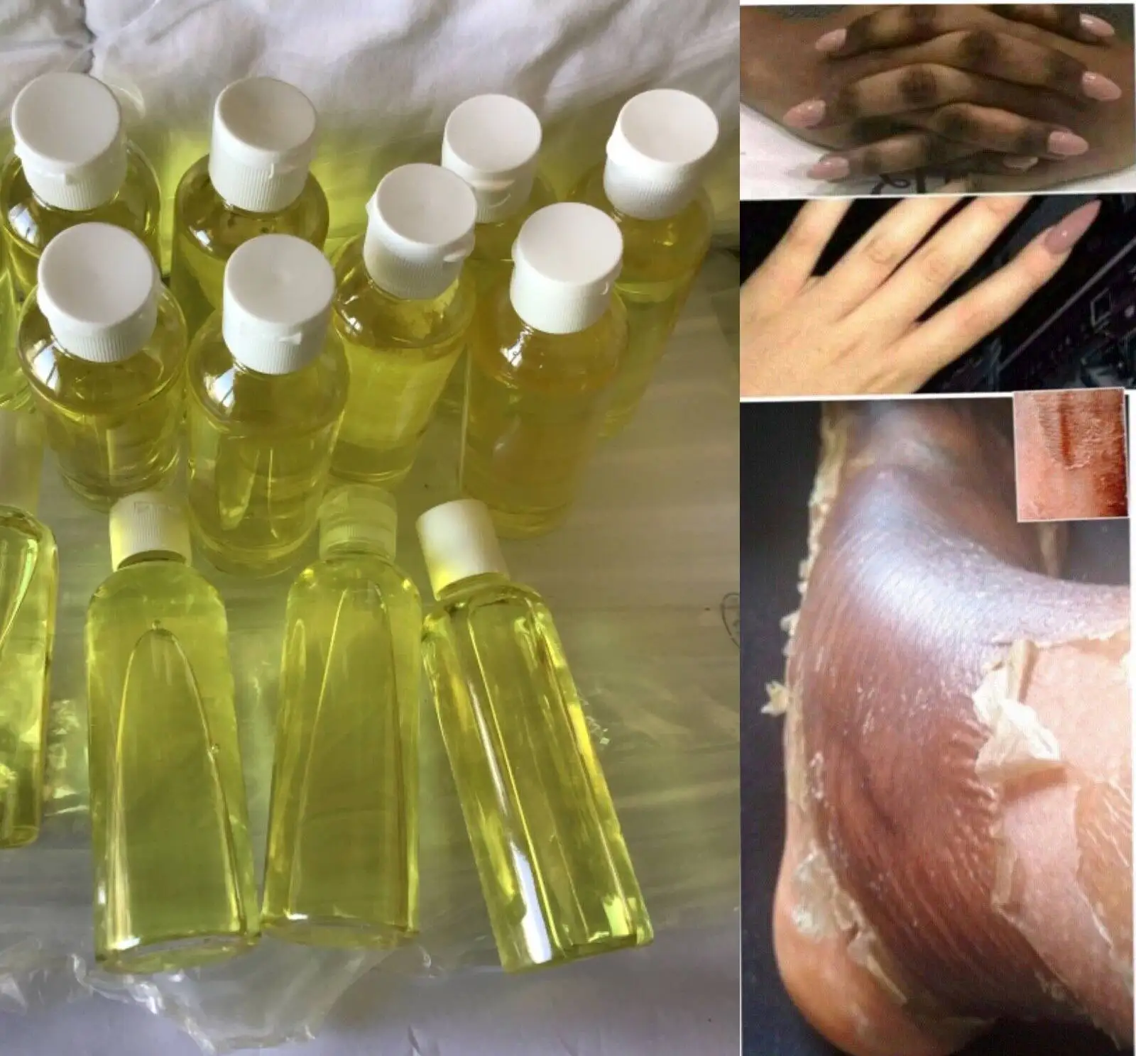Huile de Peeling Jaune avec Acide Lactique pour Traitement des Taches  Foncées, Produit Chimique pour Peeling de la Peau du Visage - AliExpress
