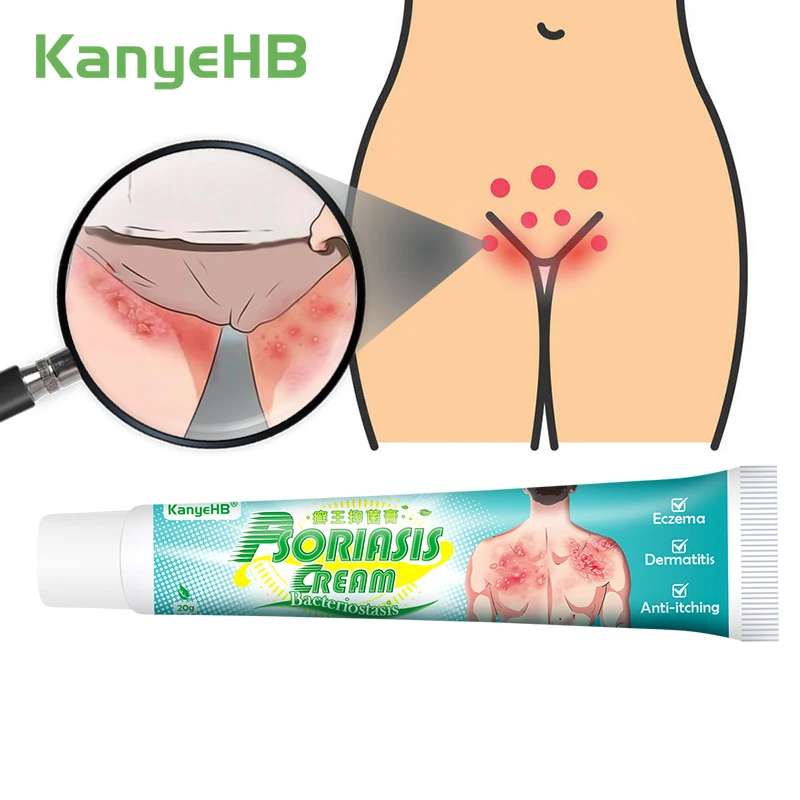 1pcs Psoriasis Cream Itch Relief Ointment Inhibit Fungi Treat Body Skin Desquamation Itch&Red Rash Dermatitis Eczema Cream G012