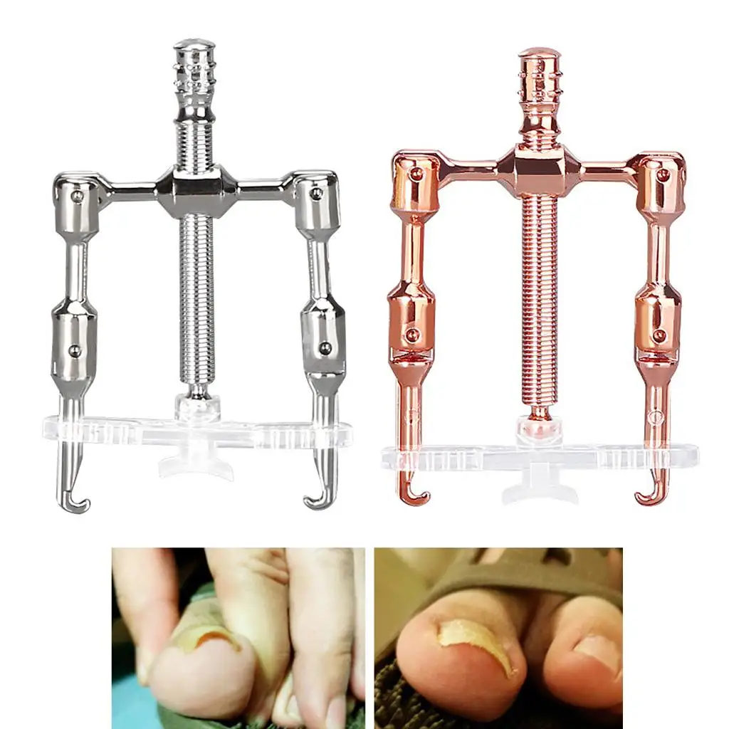 

Gold/ Nail Corrector Correction for Pedicure Ingrown Toenail